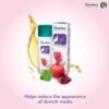 HIMALAYA, STRETCH, MARKS, CREAM, FOR, MOM,ANTI, HERBAL, AYURVEDIC, NEDICINE, HERBICHEM.COM, PREGNANT, WOMEN, LADY, FEMALE, 100ML,OIL